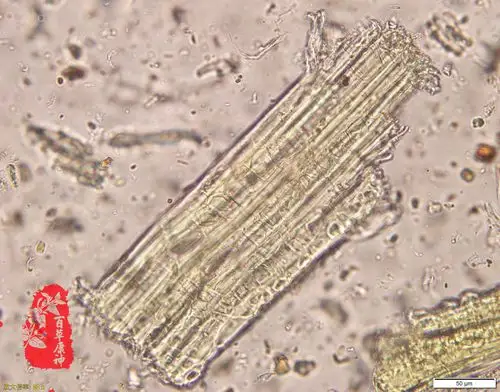 鸡骨草木栓细胞↑鸡骨草石细胞↑鸡骨草气孔