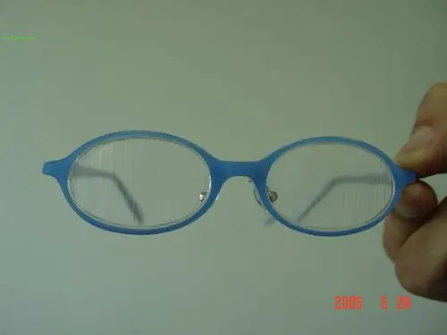 神奇三棱镜矫正大度数斜视效果好!