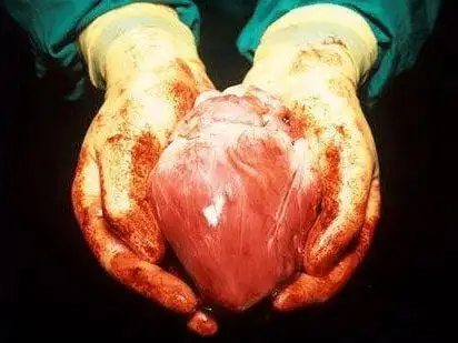 使用引起普通人群反感恶心的血腥图片,包括自残,血腥暴力图片;尸体