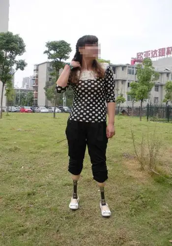 双小腿假肢装配