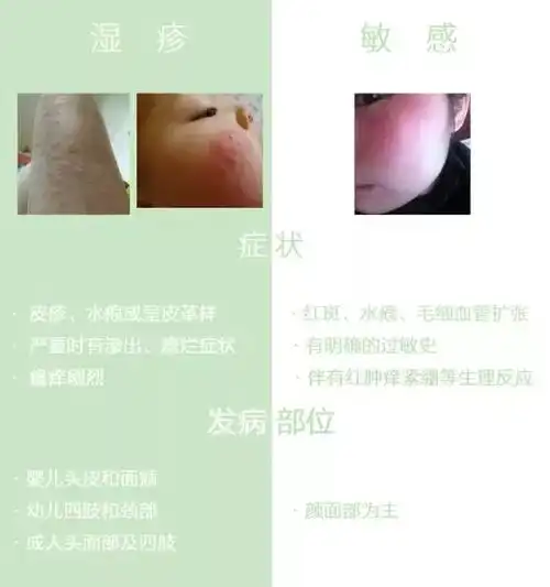 怎么判断自己是湿疹还是过敏?_凤凰网时尚_凤凰网