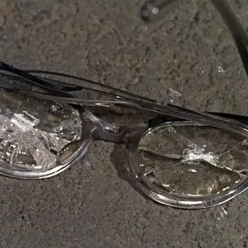 来自:豆瓣相册               #眼镜碎片# #戴碎镜片的倒霉蛋