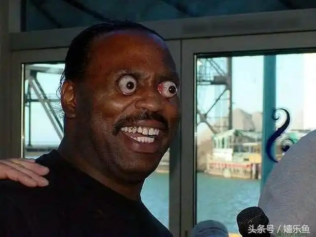 实拍世界长得最奇怪的人