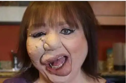 世界上最丑的女人