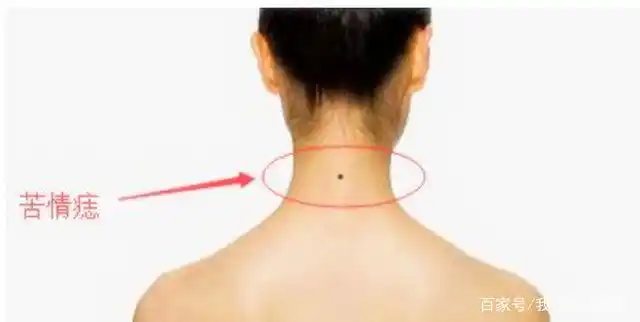为什么很多人的脖子后面都有一颗痣?今天,我们来告诉各位答案
