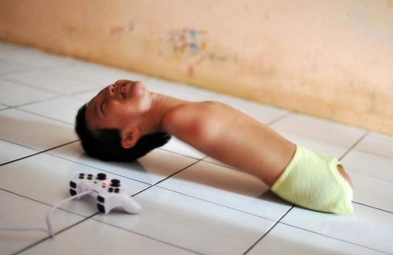 这个小男孩天生就没有四肢,但是他依然乐观的面对生活,令人佩服