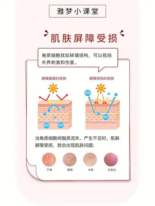 关于肌肤屏障受损