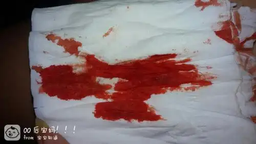 昨天还好好的今天怎么就这样了