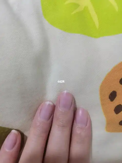 我的指甲很紫吗