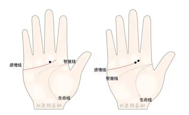 4,感情线上有两颗痣,这样的人性格敏感,非常容易情绪化,容易因为一些