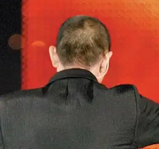 刘德华为新片《刺马》理了小平头,被发现后脑发根不若以往浓密.