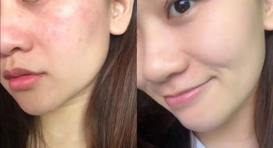 适合学生党敏感肌使用的护肤品