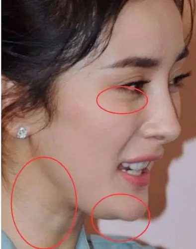 杨幂双下巴满腿黑,赵丽颖毛孔粗大黑头爆炸……女星素颜难道只有她是