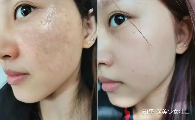 【中科院博士】推荐的美白面霜巨巨巨牛,快速美白真的会上瘾! - 知乎