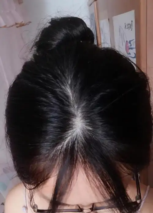 刚刚拍的,感觉头皮已经好明显