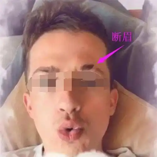 命中无子的三种面相,千万不要中