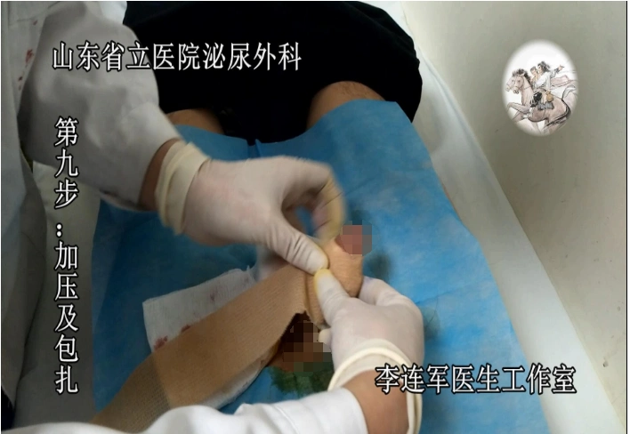 用图文实例让您看明白包皮环切器微创包皮环切术怎么做_包皮环切术