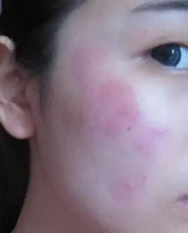 敏感肌肤大认知!