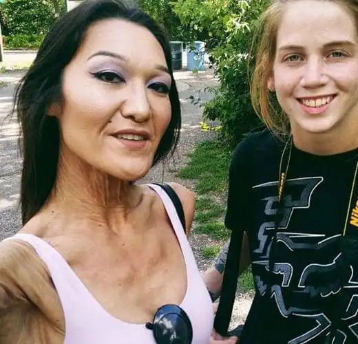 26岁女子全身皮肤松弛像80岁老人看了照片后都说不可思议