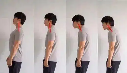 杨幂含胸驼背动图爆光!脖子前倾程度严重,网友:堪比"乌龟"