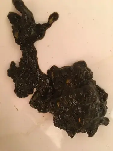 的拉这样的大便,就需要去检查一下了 追问 都是正常进食,之前经常胃疼