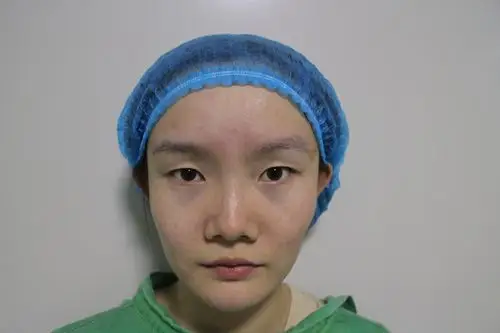 擅长:眼部整形 面部轮廓 脂肪填充       镭射定点双眼皮