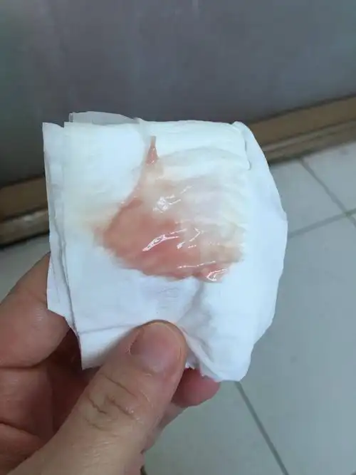 今天又出现了这样的白带