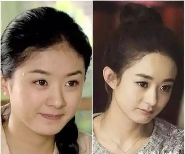 女星整容前后对比,有人美貌出众,有人惨不忍睹_柳岩