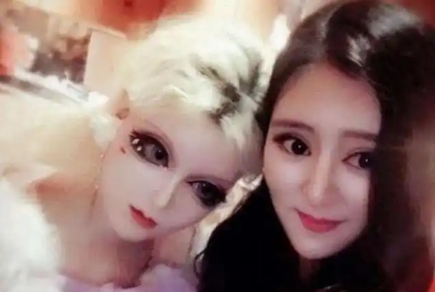 12岁女童三年整容60次花费将近上百万现状令人唏嘘