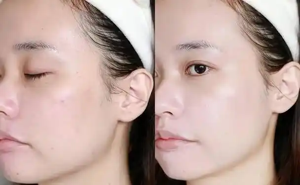 想要皮肤变好,要知道护肤的"三不",忽略了难怪肤质会不好