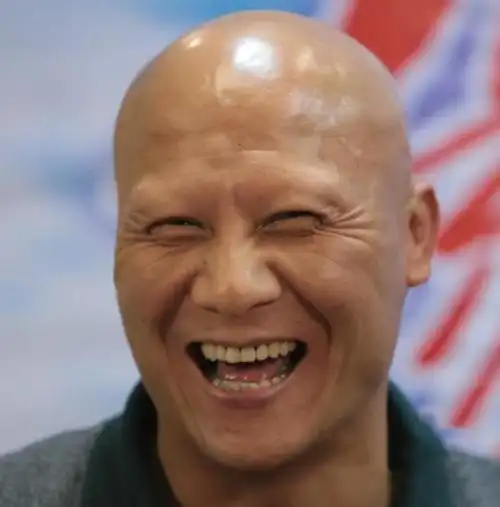 林志颖生父李连杰死对头17岁中毒毁容现在怎样了