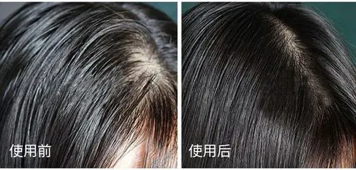 这种 养发生发功效,可是取得了 国家专利认证,在市面上都少之又少.