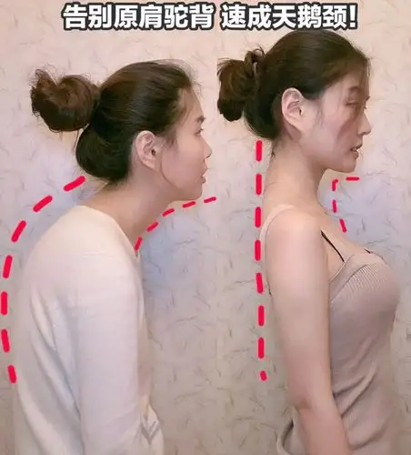 这个变态矫正带,3秒改善弯腰驼背耸肩!做回气质女人!