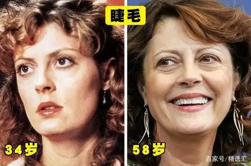 随着年龄增长,我们的身体会发生明显变化的10个部位