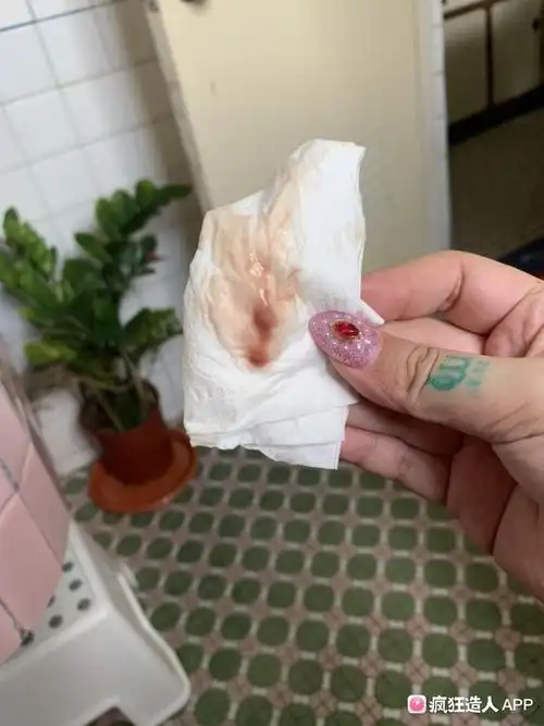 排卵第九天出血 是著床出血吗?