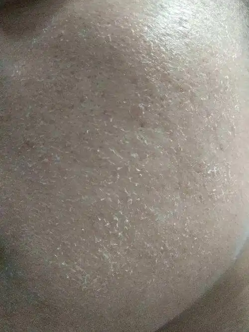 护肤,面膜一张不落下,但第二天起来之后皮肤依然跟风化的城墙没啥效果