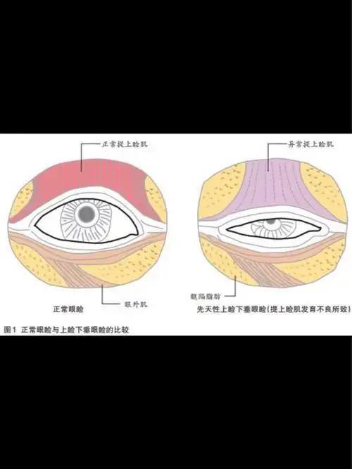 眼部多项包括哪些