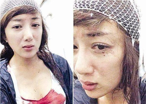 曾演过美艳妲己的李依晓,却因被狗咬而毁容,整容多次难回巅峰