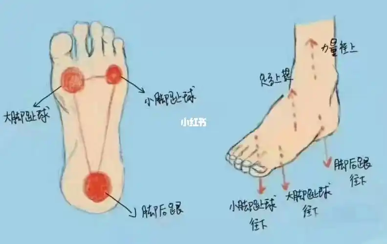 如何解决足底筋膜炎