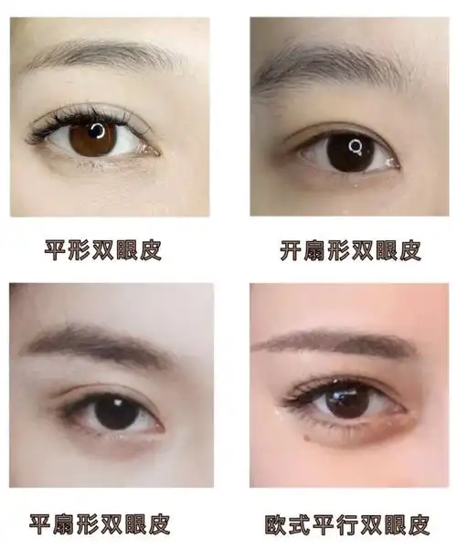 平行偏扇形双眼皮图片