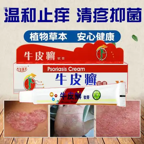 雅美肤夫洁美宝牛皮癣软膏