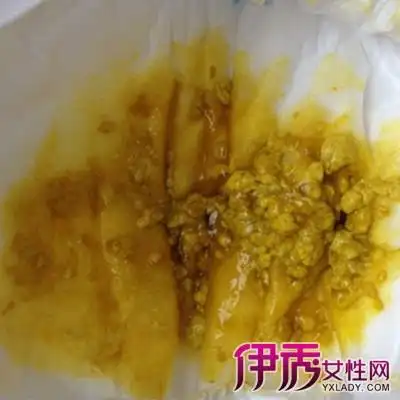 2,婴儿腹泻的症状 1腹泻轻的小儿大便每天可10次以下,黄绿色,带少量