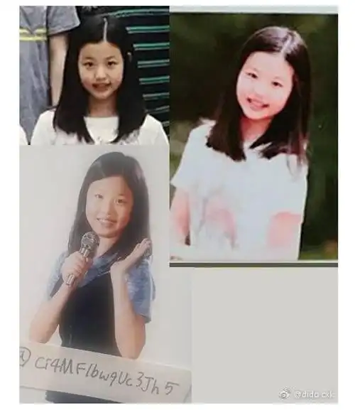 张元英10岁就整容了