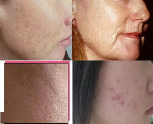 睡前有这个习惯的女生皮肤越睡越好