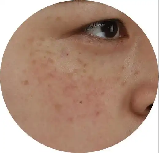 脸也变黑了,脸上的斑似乎也加重了