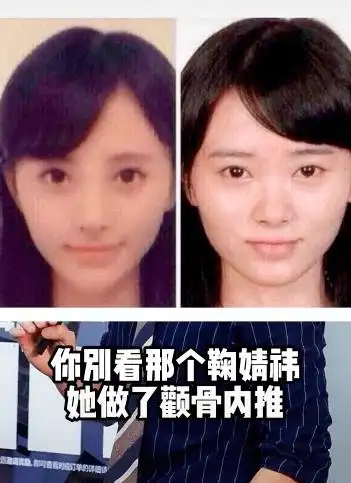男网红直言鞠婧祎做了颧骨内推后遗症多,网友吐槽难怪她吃面包嚼几十