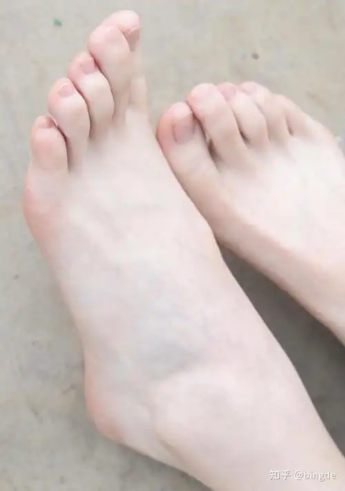 女孩子脚都很臭吗,还是只有个例? - 知乎