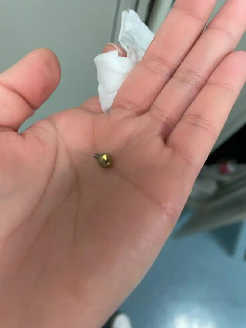 种植牙基台脱落了 今天早上下夜班刷牙漱口的时候,基台脱落了,当时好