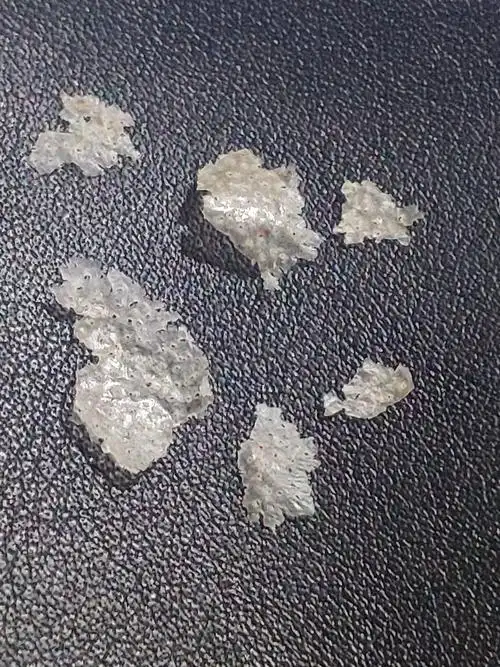 见过的最大头皮屑多大