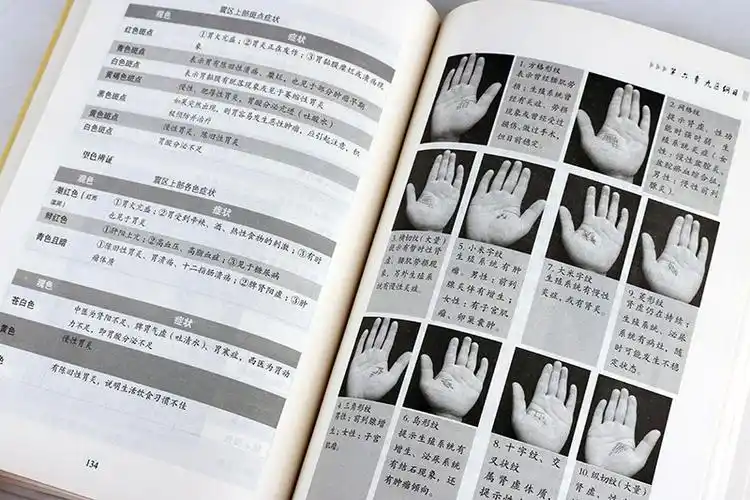 养生手诊大全中医医学入门看诊入门书快速诊学中医养生